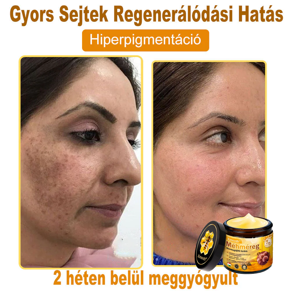 🏆🐝 𝐗𝐢𝐦𝐨𝐧𝐭𝐡® 𝑴é𝒉𝒎é𝐫𝐞𝐠 𝐁ő𝐫 𝑯𝒆𝒍𝒚𝒓𝐞á𝐥𝐥í𝐭ó 𝐊𝐫é𝒎 🔥 Magyar fejlesztés, magyarországi gyártás és szállítás