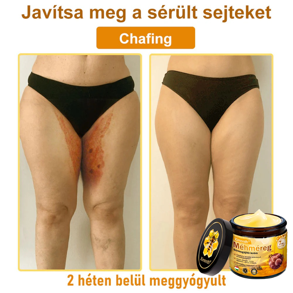 🏆🐝 𝐗𝐢𝐦𝐨𝐧𝐭𝐡® 𝑴é𝒉𝒎é𝐫𝐞𝐠 𝐁ő𝐫 𝑯𝒆𝒍𝒚𝒓𝐞á𝐥𝐥í𝐭ó 𝐊𝐫é𝒎 🔥 Magyar fejlesztés, magyarországi gyártás és szállítás