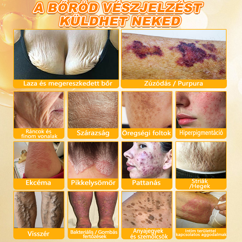 𝐃𝐚𝐚𝑠𝒓𝒚® 8-𝗮𝘇-𝟭-𝒃𝒆𝒏 𝑴é𝒉𝒎é𝒓𝒆𝒈 & 𝑭𝒂𝒈𝒈𝒚ú 𝑩ő𝒓𝒇𝒆𝒔𝒛𝒆𝒔í𝒕ő é𝒔 𝑹𝒆𝒈𝒆𝒏𝒆𝒓á𝒍ó 𝑲𝒓é𝒎