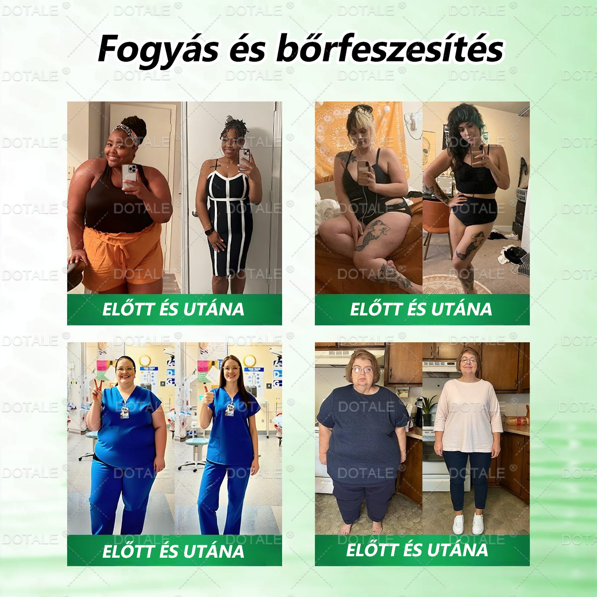𝑫𝑶𝖳𝖠𝐋𝐄® 𝑴𝒆𝐭𝐚𝐛𝐨𝐥𝐢𝐤𝐮𝐬 𝑵𝒂𝐧𝐨 𝑴𝒊𝒌𝒓𝐨𝐭ú𝐬 𝑇𝑎𝒑𝐚𝐬𝐳🎊 (Csak naponta egyszer használható, látható eredmények 7 napon belül!) ✅ Berenil + Moringa formuláció, ideális tömegtúlzsúlláshoz, bőrhiányossághoz, cukorbetegséghez, apnához és ízületi problémákhoz 💥💥