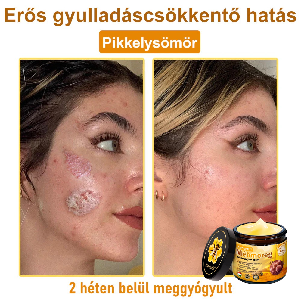 🏆🐝 𝐗𝐢𝐦𝐨𝐧𝐭𝐡® 𝑴é𝒉𝒎é𝐫𝐞𝐠 𝐁ő𝐫 𝑯𝒆𝒍𝒚𝒓𝐞á𝐥𝐥í𝐭ó 𝐊𝐫é𝒎 🔥 Magyar fejlesztés, magyarországi gyártás és szállítás