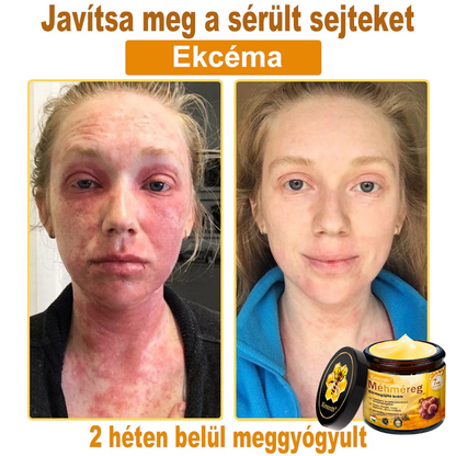 🏆🐝 𝐗𝐢𝐦𝐨𝐧𝐭𝐡® 𝑴é𝒉𝒎é𝐫𝐞𝐠 𝐁ő𝐫 𝑯𝒆𝒍𝒚𝒓𝐞á𝐥𝐥í𝐭ó 𝐊𝐫é𝒎 🔥 Magyar fejlesztés, magyarországi gyártás és szállítás