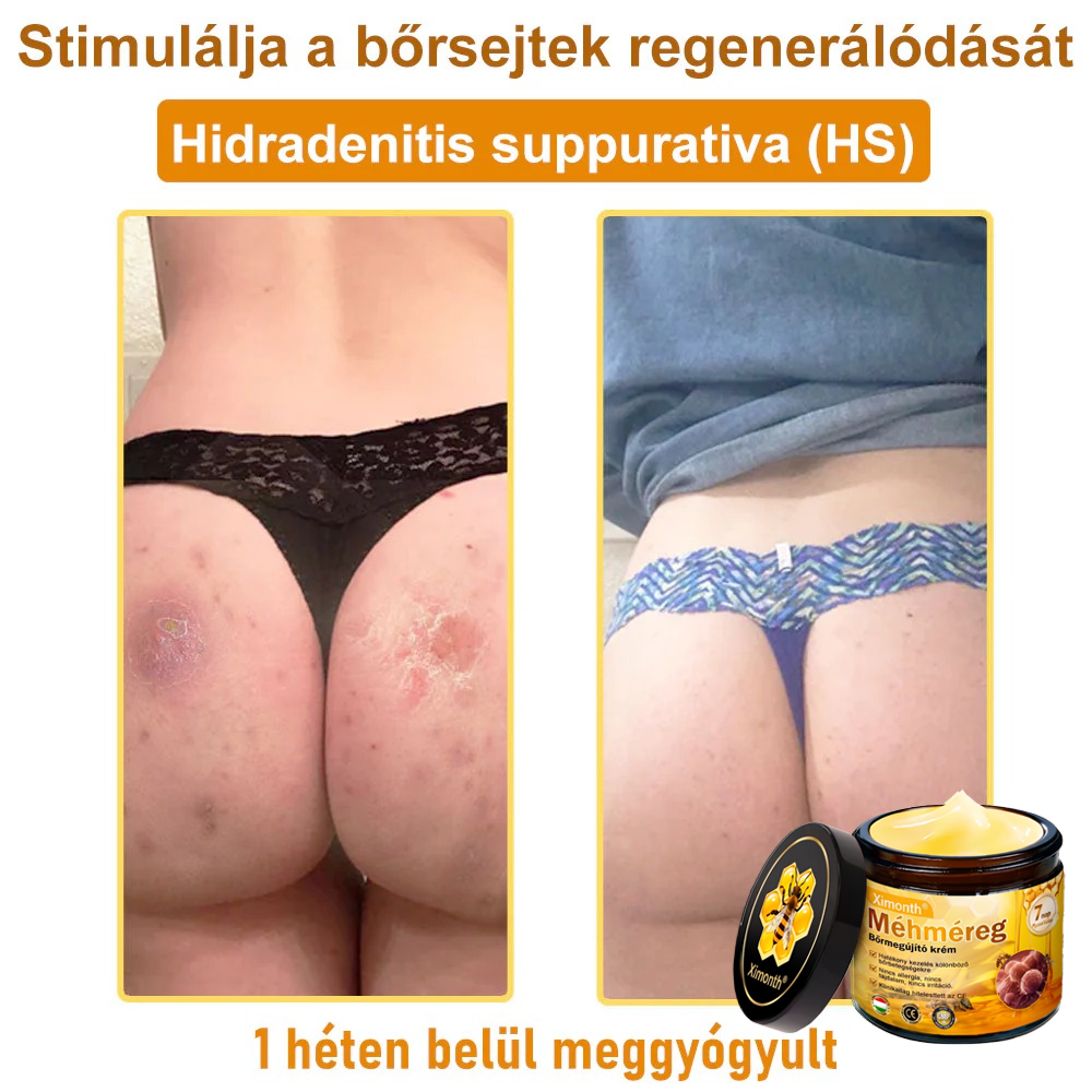 🏆🐝 𝐗𝐢𝐦𝐨𝐧𝐭𝐡® 𝑴é𝒉𝒎é𝐫𝐞𝐠 𝐁ő𝐫 𝑯𝒆𝒍𝒚𝒓𝐞á𝐥𝐥í𝐭ó 𝐊𝐫é𝒎 🔥 Magyar fejlesztés, magyarországi gyártás és szállítás