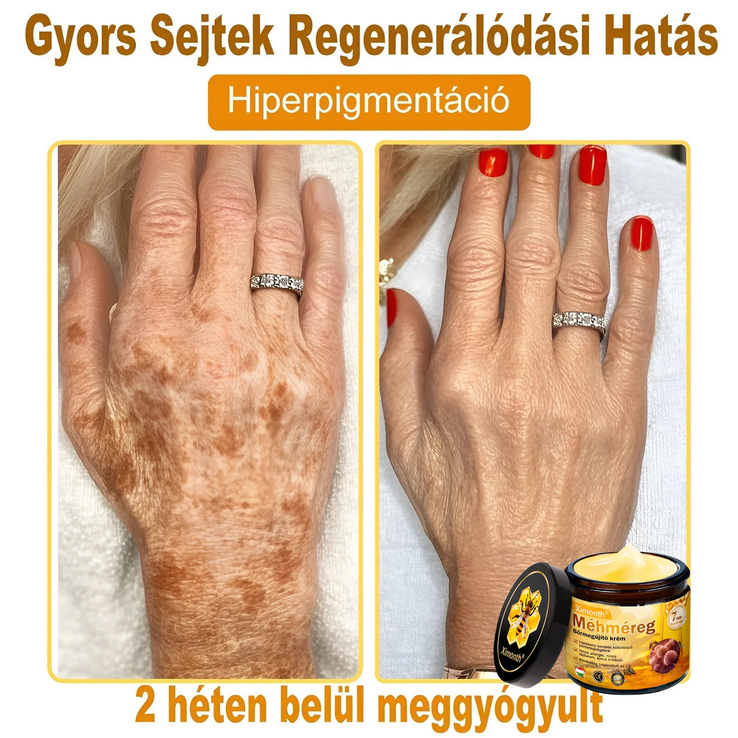 🏆🐝 𝐗𝐢𝐦𝐨𝐧𝐭𝐡® 𝑴é𝒉𝒎é𝐫𝐞𝐠 𝐁ő𝐫 𝑯𝒆𝒍𝒚𝒓𝐞á𝐥𝐥í𝐭ó 𝐊𝐫é𝒎 🔥 Magyar fejlesztés, magyarországi gyártás és szállítás