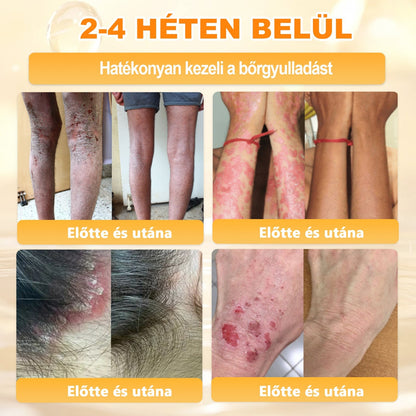 𝐃𝐚𝐚𝑠𝒓𝒚® 8-𝗮𝘇-𝟭-𝒃𝒆𝒏 𝑴é𝒉𝒎é𝒓𝒆𝒈 & 𝑭𝒂𝒈𝒈𝒚ú 𝑩ő𝒓𝒇𝒆𝒔𝒛𝒆𝒔í𝒕ő é𝒔 𝑹𝒆𝒈𝒆𝒏𝒆𝒓á𝒍ó 𝑲𝒓é𝒎