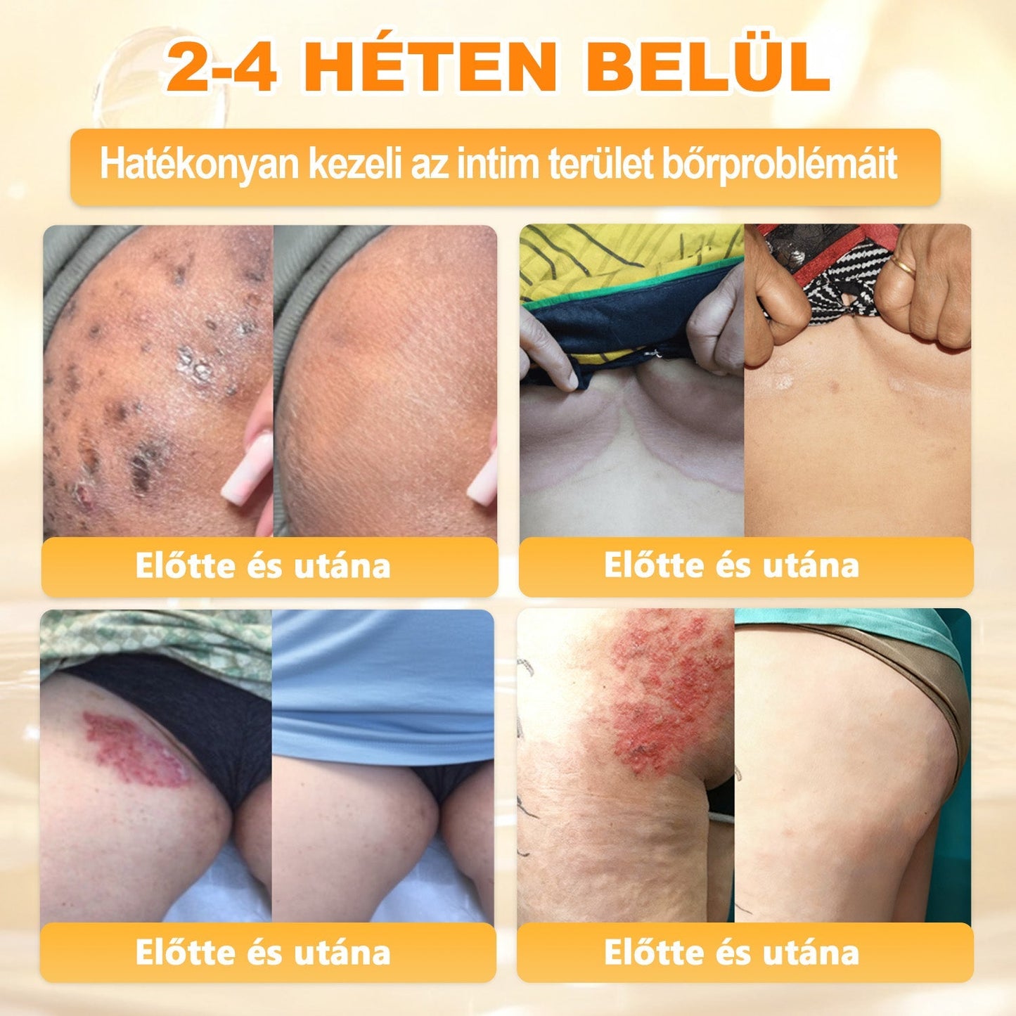 𝐃𝐚𝐚𝑠𝒓𝒚® 8-𝗮𝘇-𝟭-𝒃𝒆𝒏 𝑴é𝒉𝒎é𝒓𝒆𝒈 & 𝑭𝒂𝒈𝒈𝒚ú 𝑩ő𝒓𝒇𝒆𝒔𝒛𝒆𝒔í𝒕ő é𝒔 𝑹𝒆𝒈𝒆𝒏𝒆𝒓á𝒍ó 𝑲𝒓é𝒎