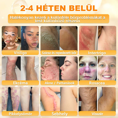 𝐃𝐚𝐚𝑠𝒓𝒚® 8-𝗮𝘇-𝟭-𝒃𝒆𝒏 𝑴é𝒉𝒎é𝒓𝒆𝒈 & 𝑭𝒂𝒈𝒈𝒚ú 𝑩ő𝒓𝒇𝒆𝒔𝒛𝒆𝒔í𝒕ő é𝒔 𝑹𝒆𝒈𝒆𝒏𝒆𝒓á𝒍ó 𝑲𝒓é𝒎